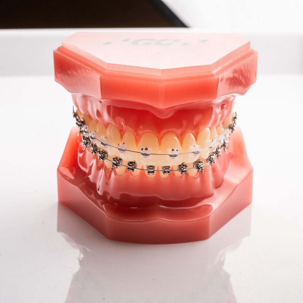 Appareil dentaire transparent