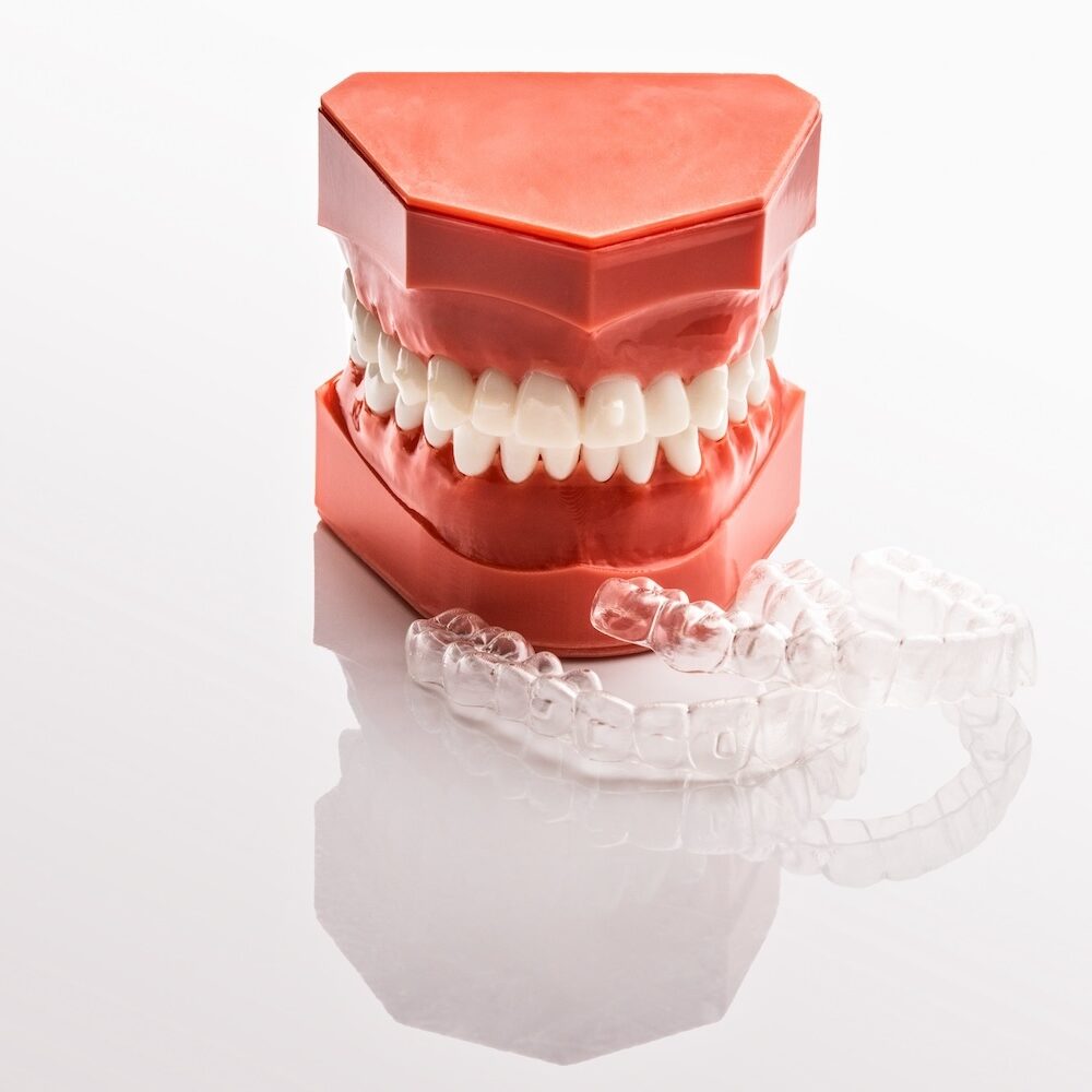 Aligneur transparent